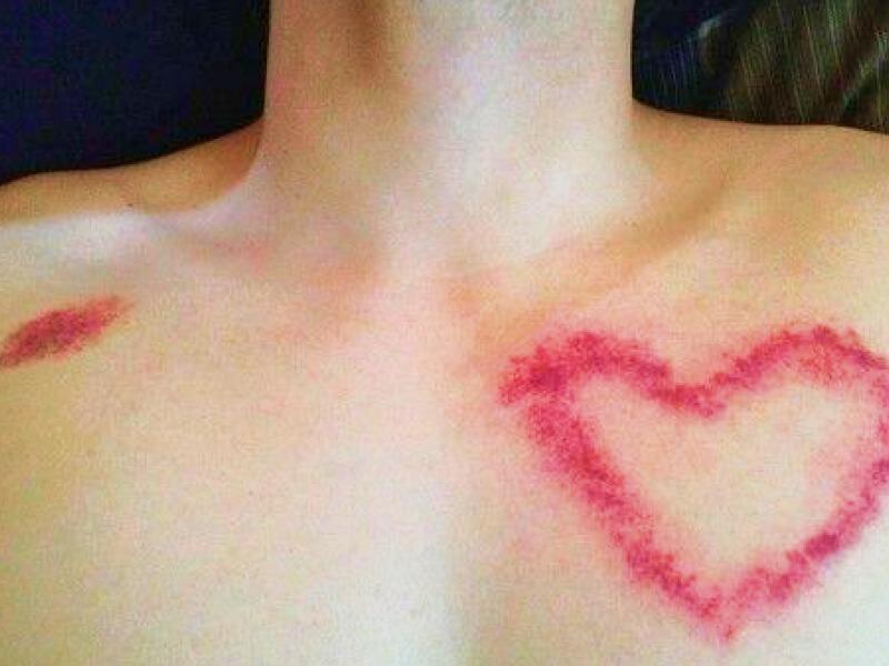 Sonhar com Chupões do meu EX