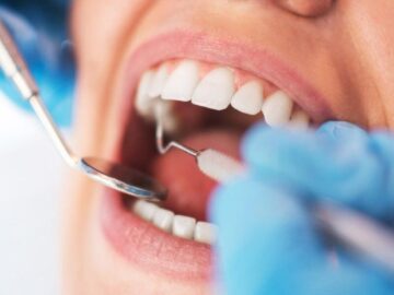 Thumbnail Sonhar com Dentista e Dentes