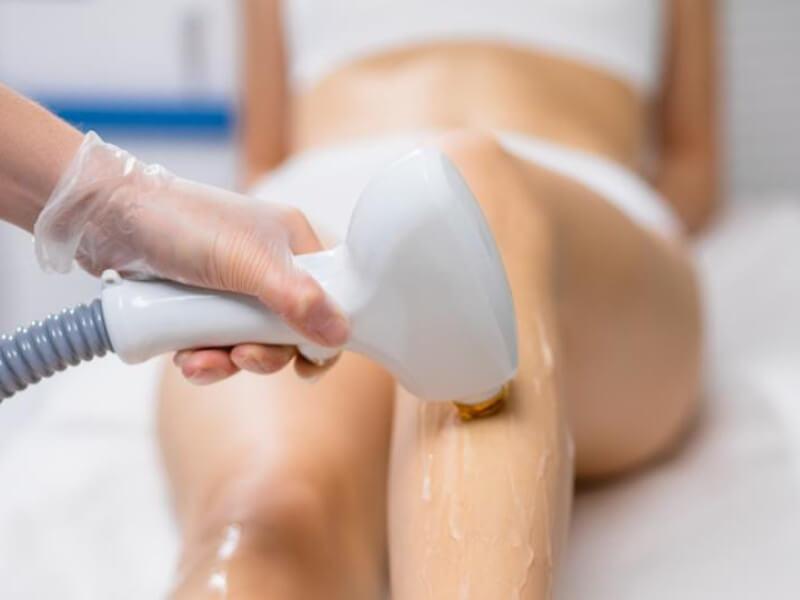 Sonhar com Depilação a Laser