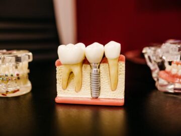 Thumbnail Sonhar com Dentes Caídos