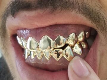 Sonhar com Dentes de Ouro
