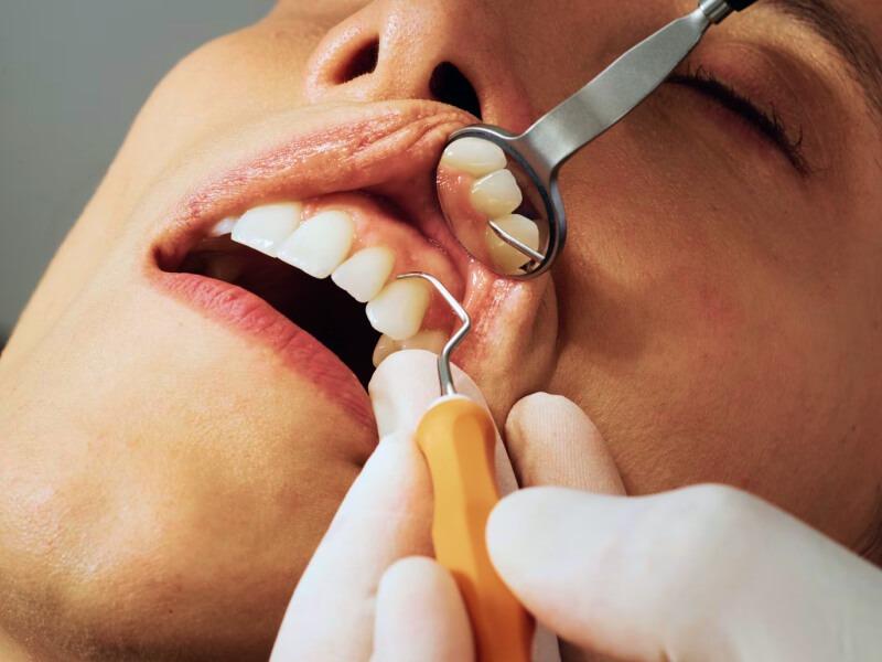 Sonhar com Dentes Desgastados