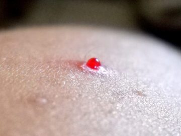 Thumbnail Sonhar com Grãos de Sangue
