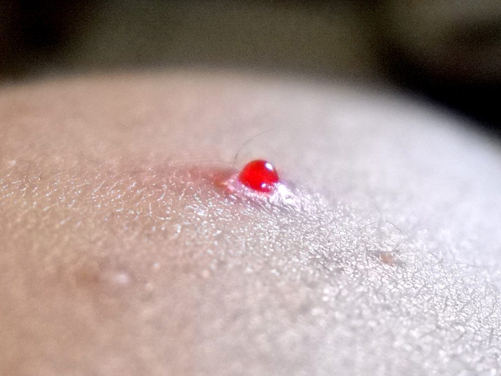 Sonhar com Grãos de Sangue