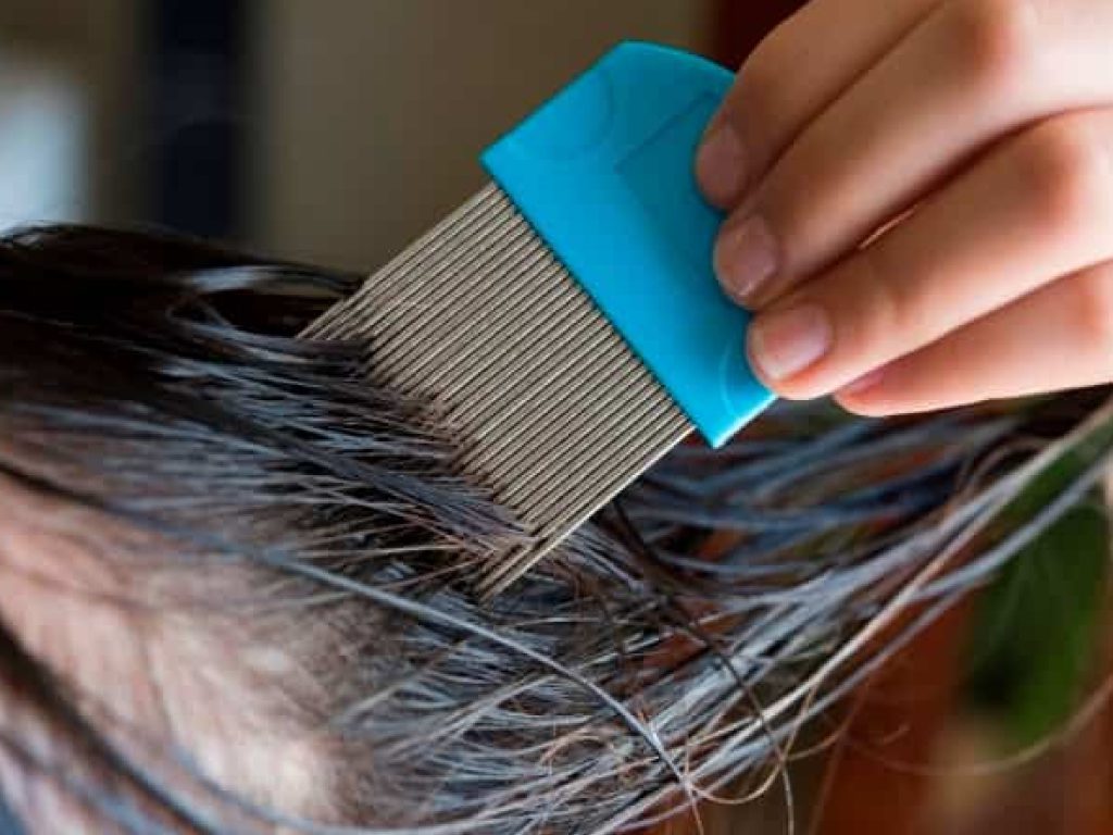Sonhar com Lêndeas no Cabelo