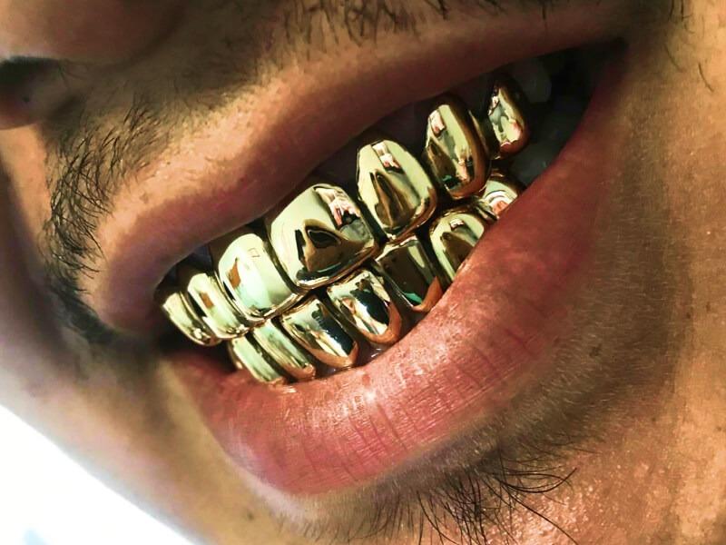 Sonhar com Dente de Ouro