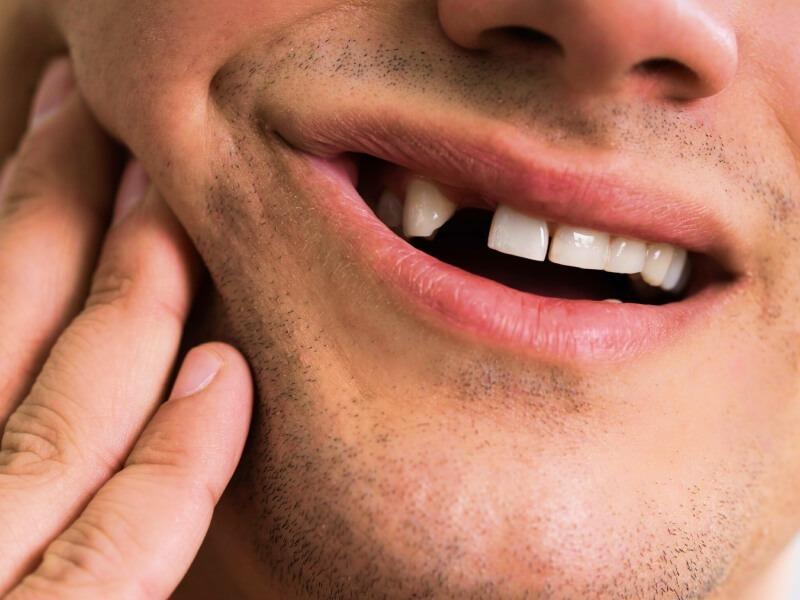 Sonhar com Dente Destruído